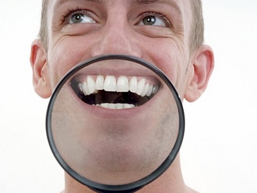 Come affrontare macchie bianche sui denti