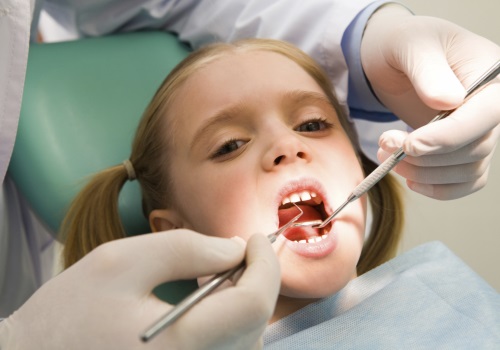 Come affrontare macchie bianche sui denti