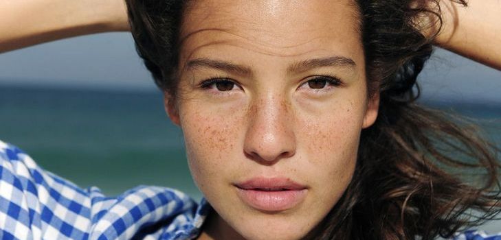 Come sbarazzarsi di freckles per sempre: significa provare a casa