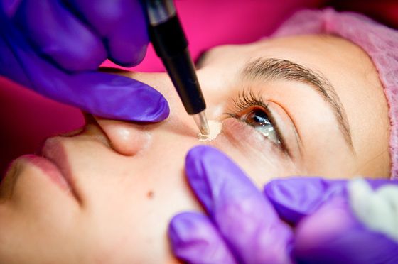 Trucco permanente per nascondere i lividi sotto gli occhi