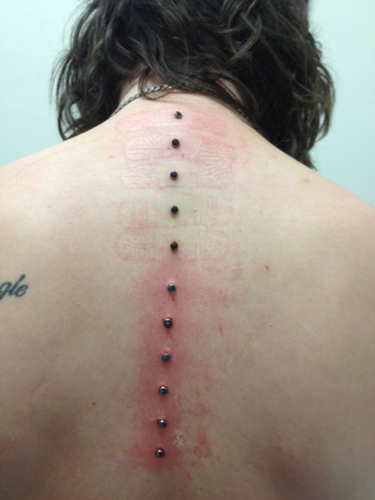 Piercing microdermico: come sono fatti i microdermoabbra (foto)