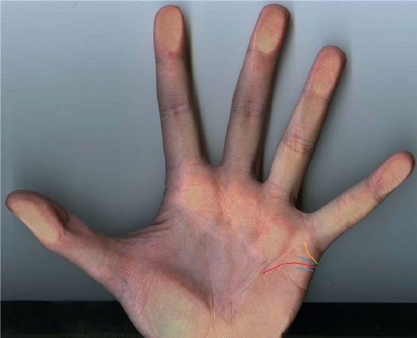 La linea di matrimonio sulla mano