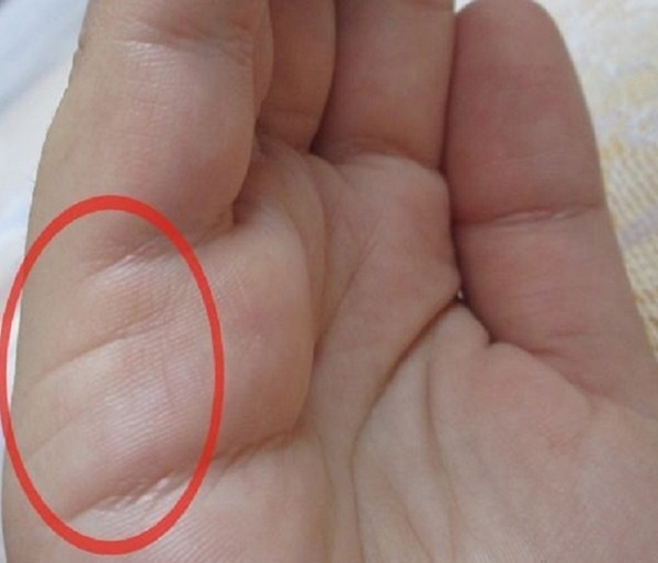 La linea di matrimonio sulla mano
