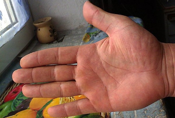 La linea di matrimonio sulla mano
