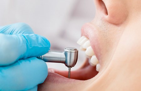 Visita dal dentista