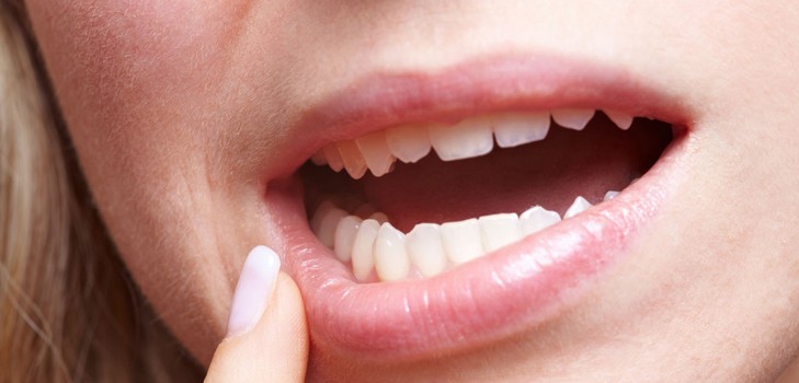 Perché prude i denti in un adulto