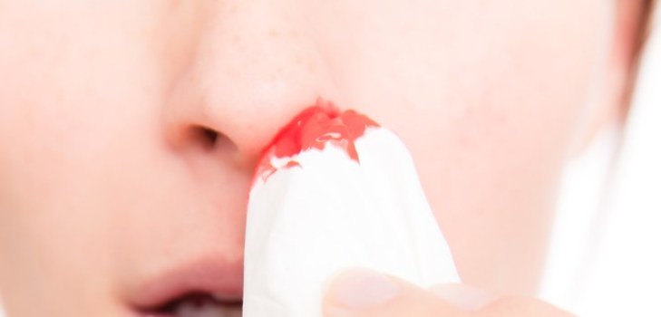 sangue dal naso