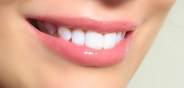 L'impianto dentale è un lusso o una necessità? 