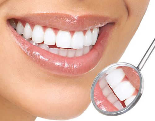 L'impianto dentale è un lusso o una necessità? 