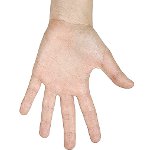 Come sbarazzarsi delle verruche sulle tue mani