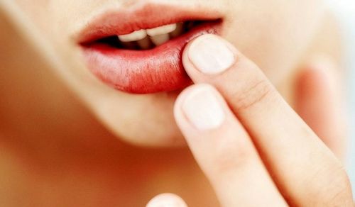  Un modo rapido ed efficace per curare i raffreddori sulle labbra: semplici ricette