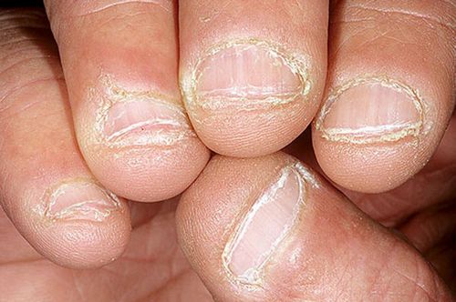 Come riconoscere e cosa fare in caso di disturbi metabolici