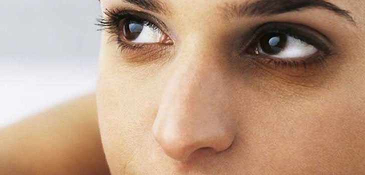 Rimedio per le contusioni sotto gli occhi